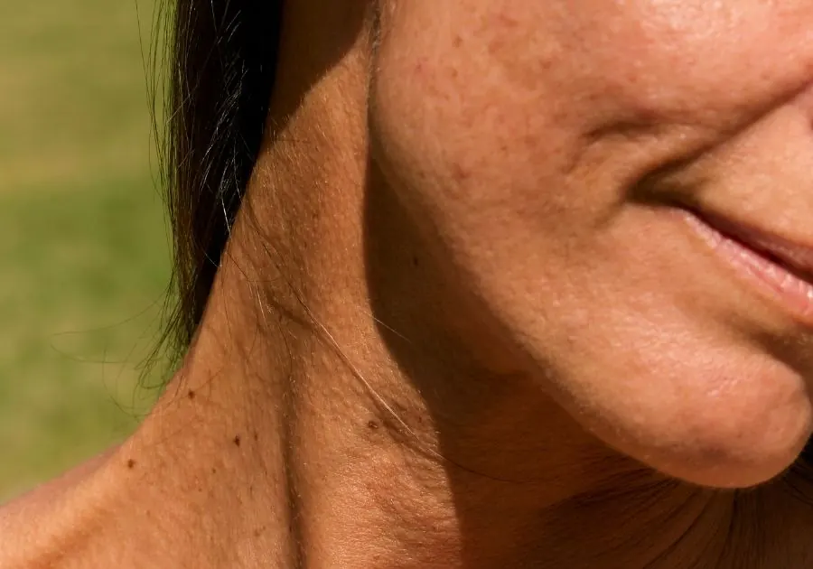 Wrinkles & Fine Lines care at Revita Luxe Miami