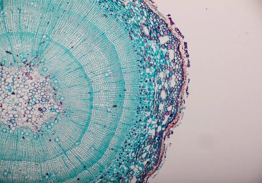 Mesenchymal Stem Cells (MSCs) IV Therapy at Revita Luxe