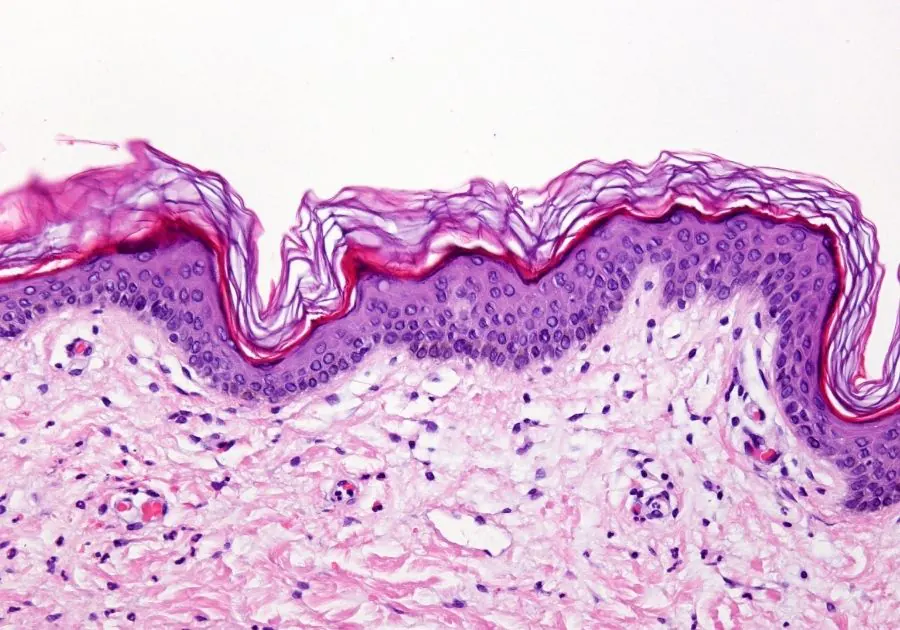 Microneedling with Mesenchymal Stem Cells at Revita Luxe