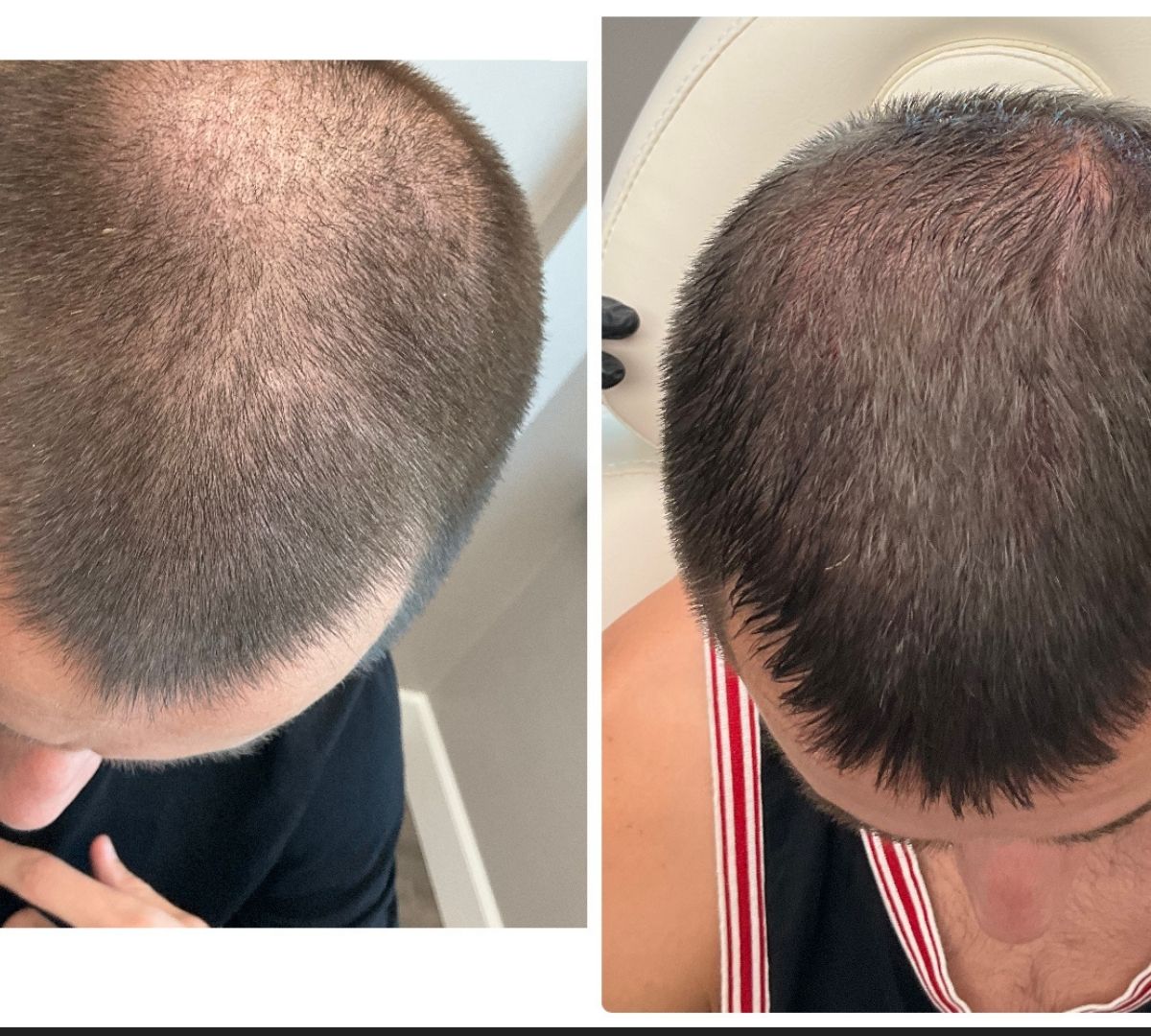 Before After (1)