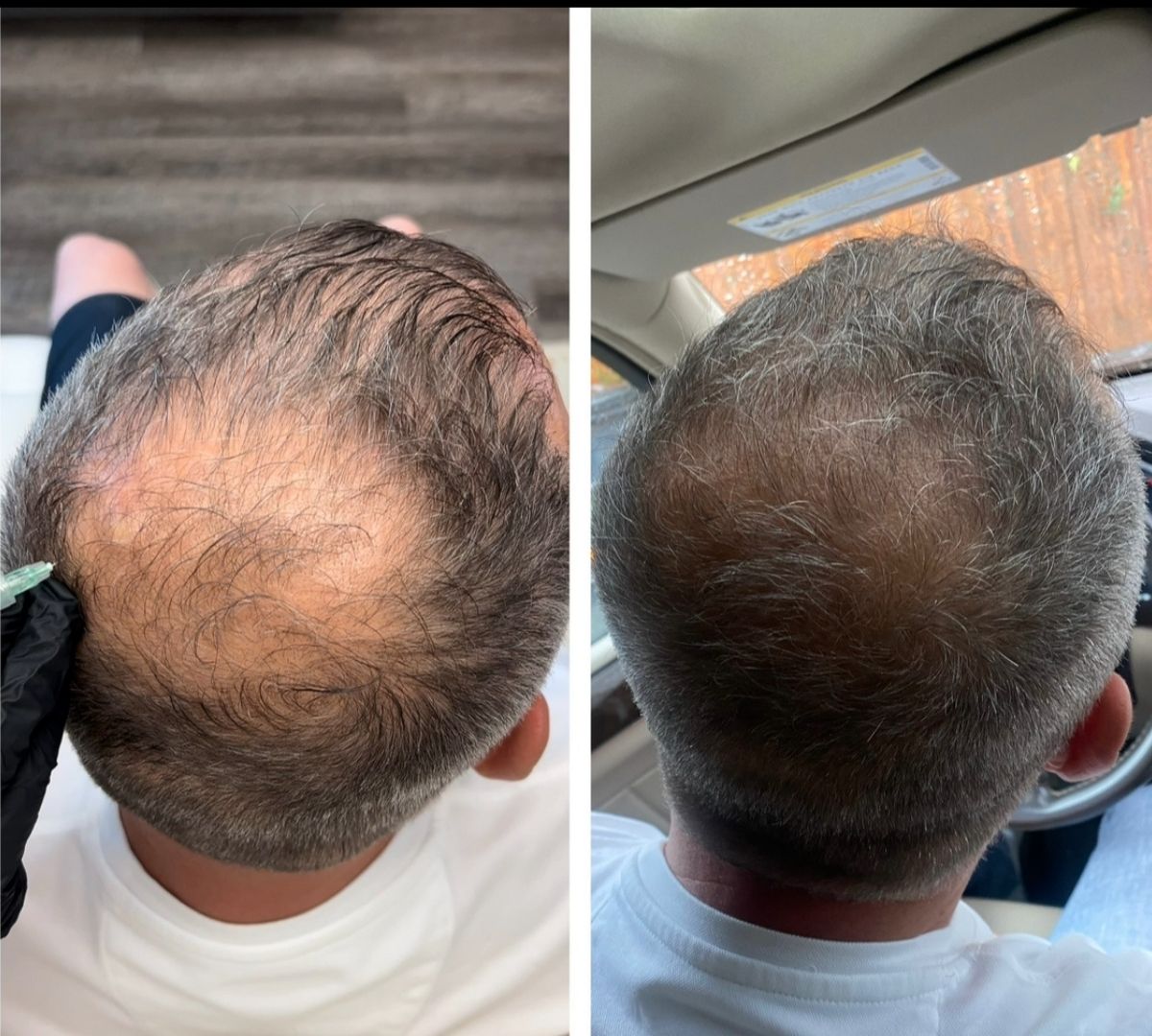 Before After