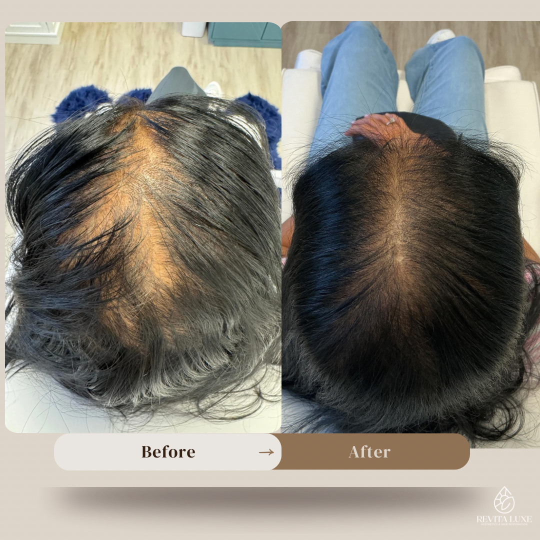 F5EF65C5-24B2-4068-BD73-08B966DF9006